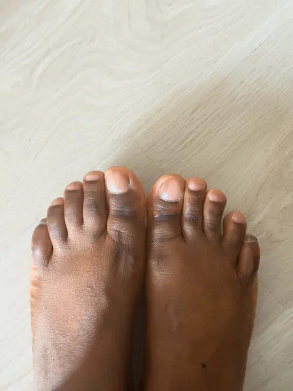 Pied à la peau souple posé sur du lin crème